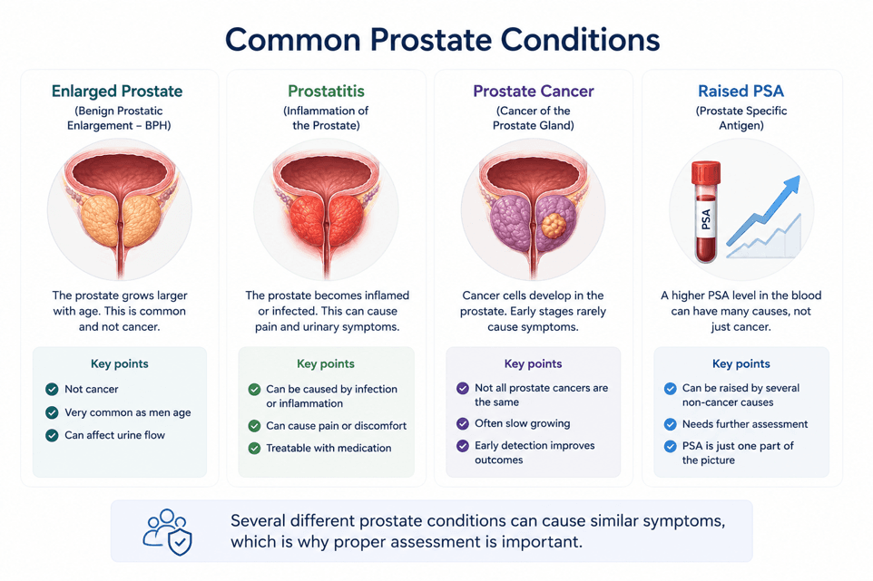 Illustration comparing enlarged prostate, prostatitis, prostate cancer and raised PSA