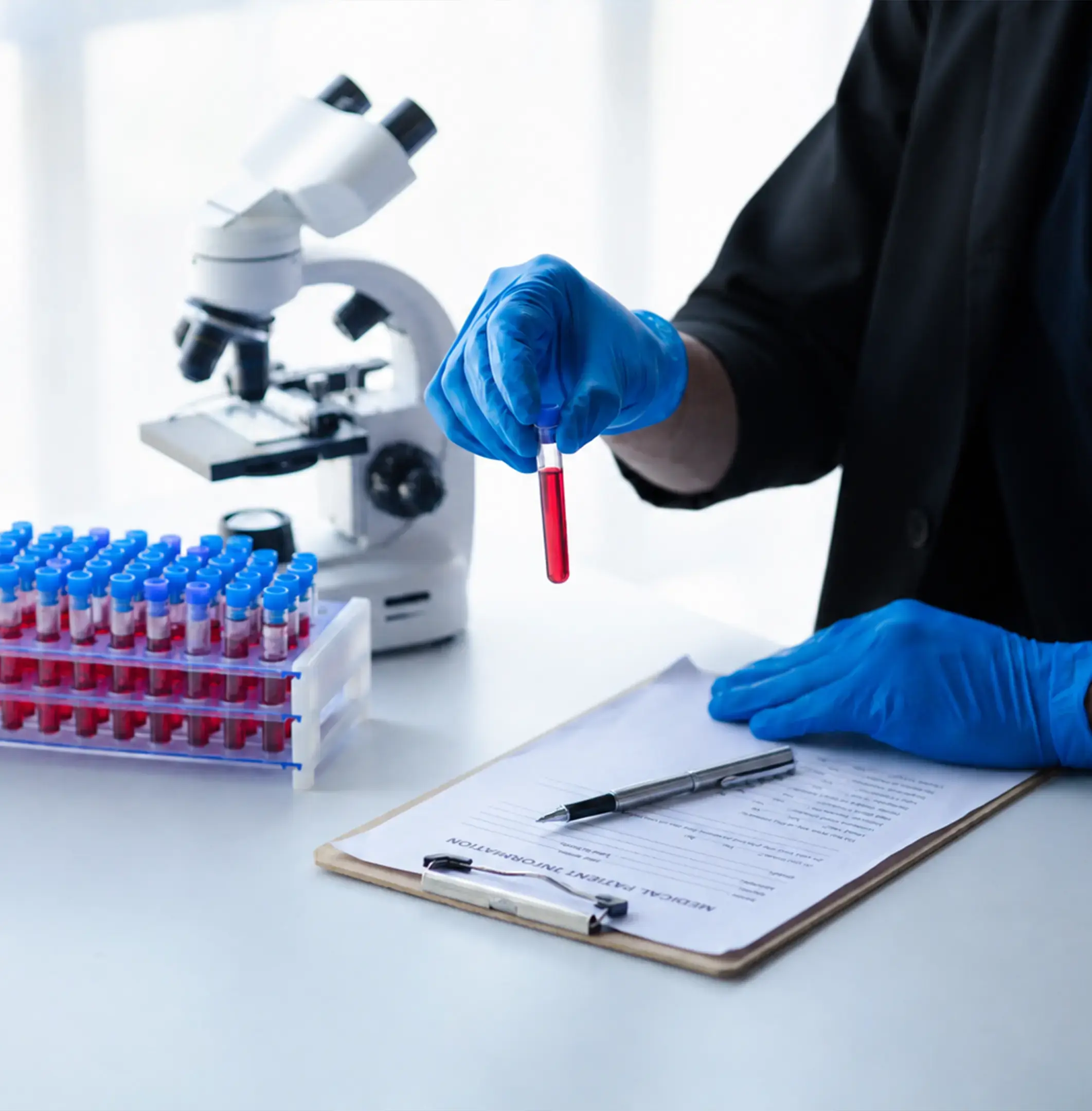Gloved hand holding a blood sample tube beside a microscope for a PSA test